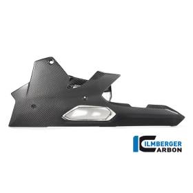 Sabot moteur version longue sans béquille centrale BMW S 1000 XR (-20) - Ilmberger Carbon