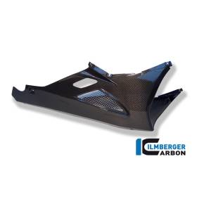 Sabot moteur - BMW K 1200 S / K 1300 S (K 1200 S (2005-2008), K 1300 S (ab 2008) - Ilmberger Carbon